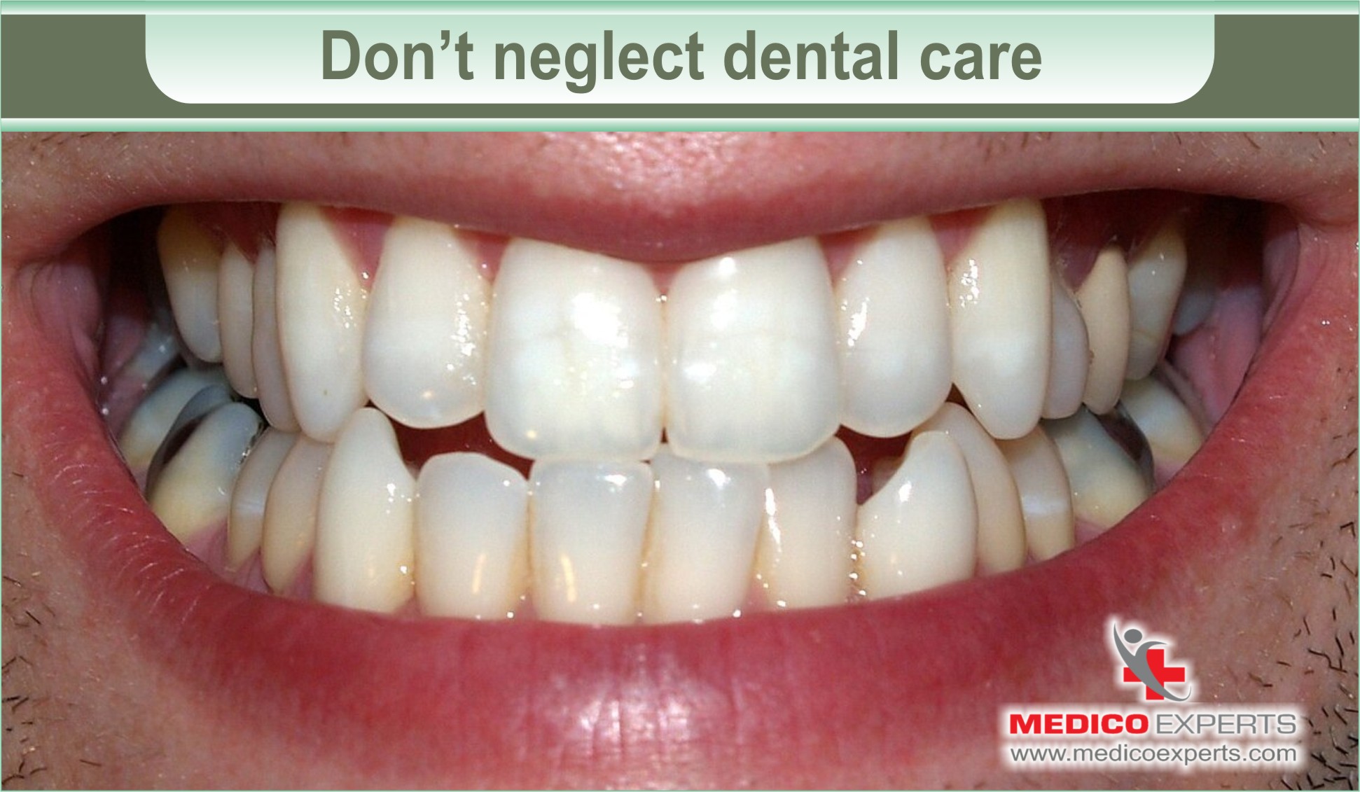 13 things not to do while on chemotherapy