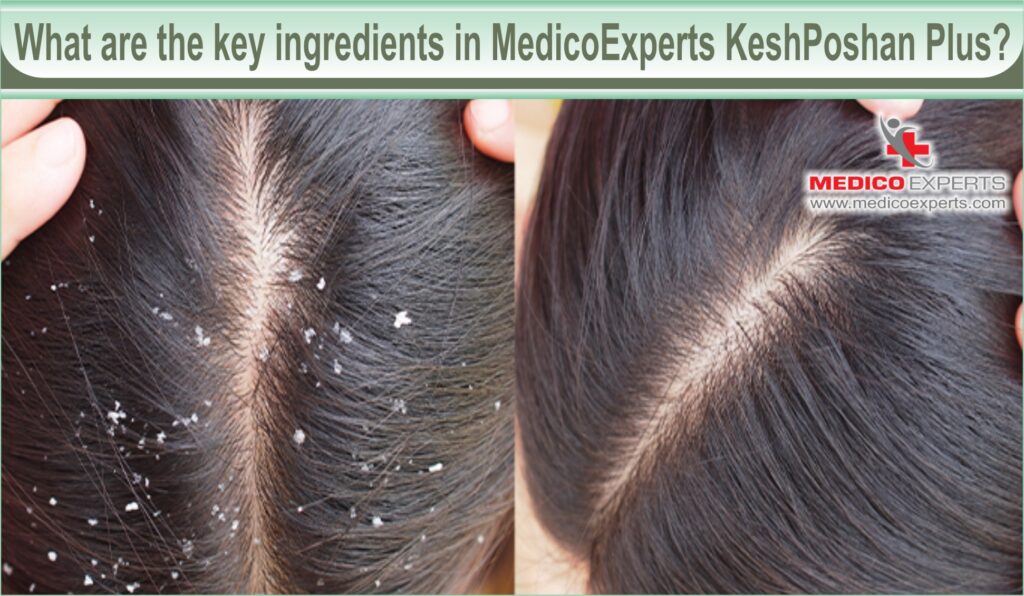 KeshPoshan Medicoexperts