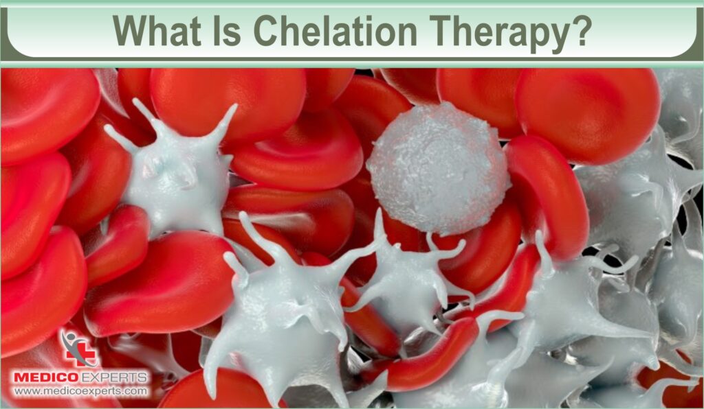 chelation therapy for heart disease