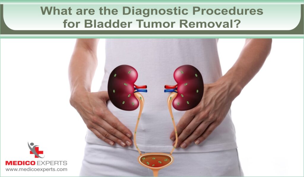 Diagnostic Procedures for Bladder Tumor Removal