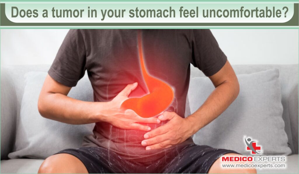 Does a tumor in your stomach feel uncomfortable