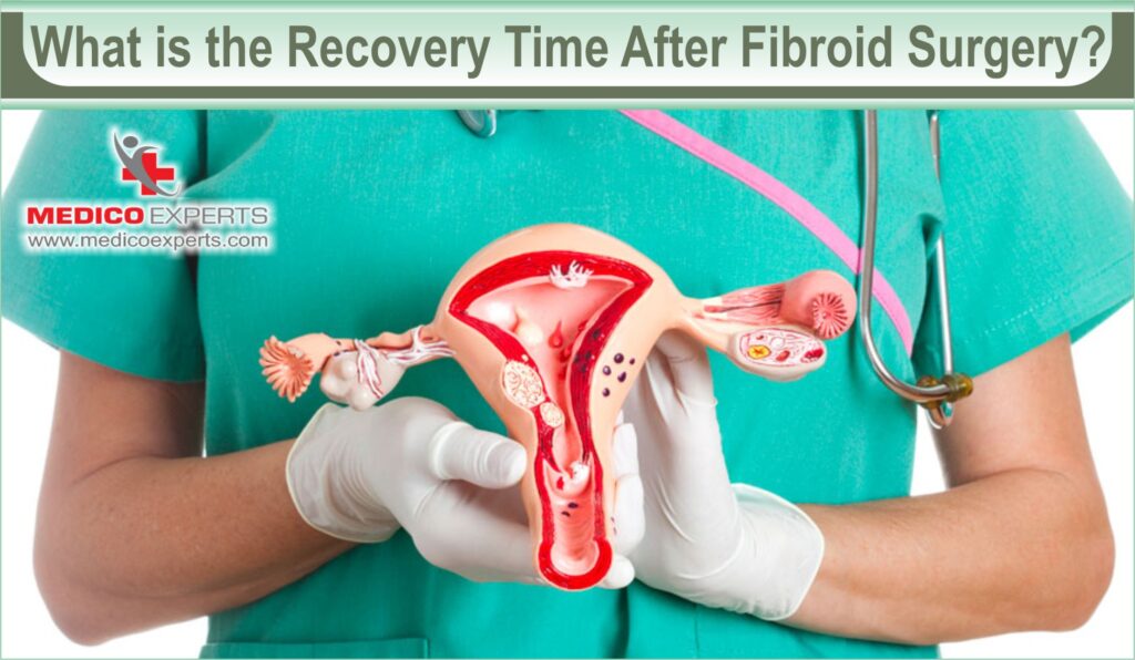 What is the Recovery Time After Fibroid Surgery