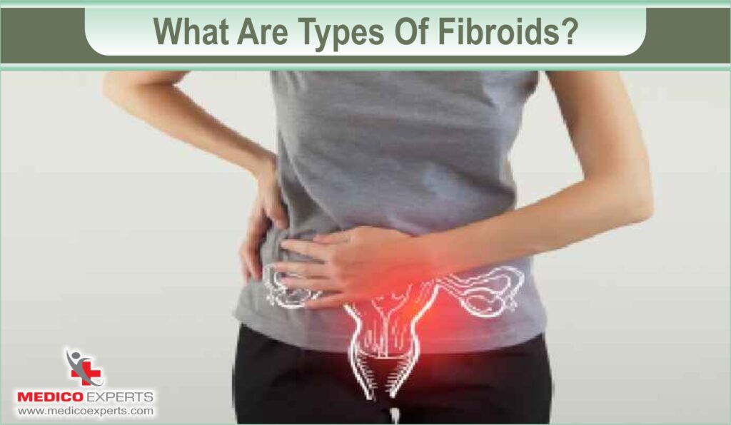 types of fibroids