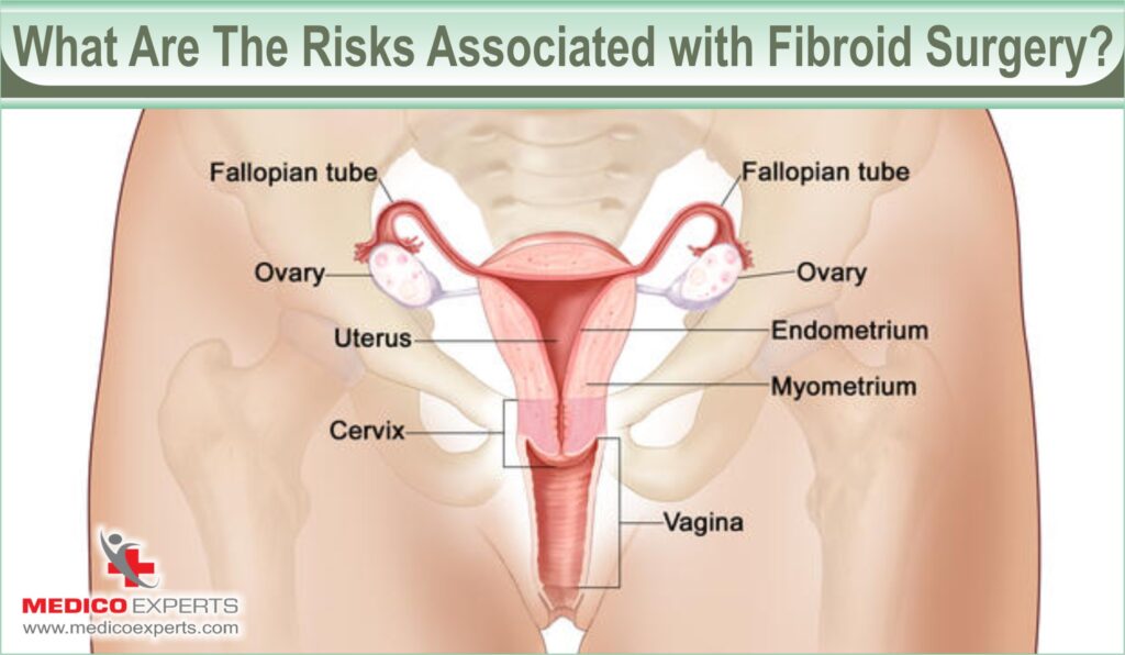 is fibroid surgery painful