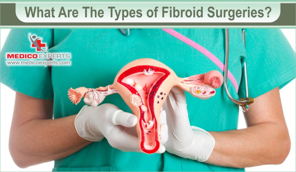 types of fibroid surgery