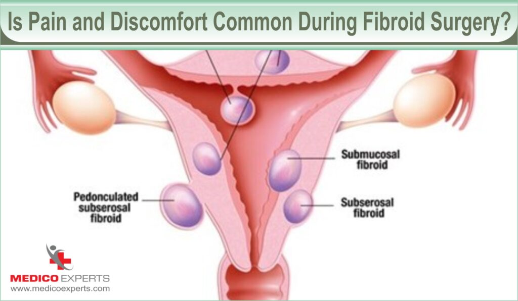pain and discomfort during fibroid surgery