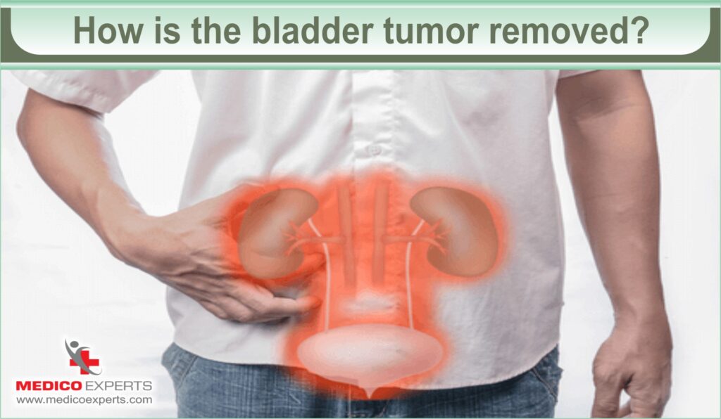 How is the bladder tumor removed