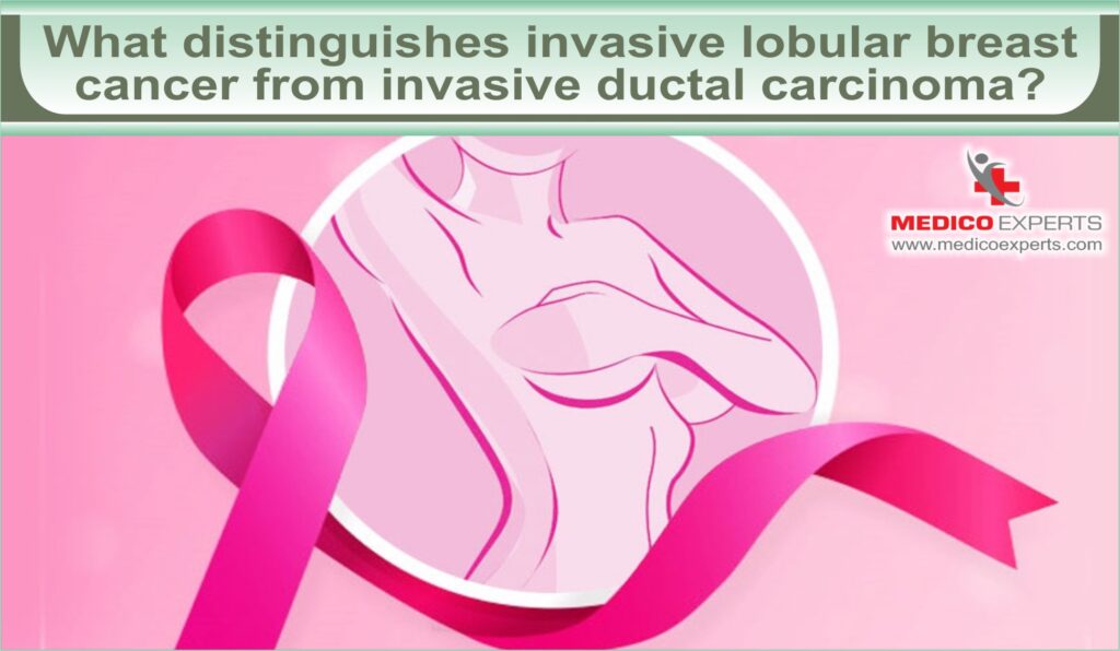 invasive lobular carcinoma