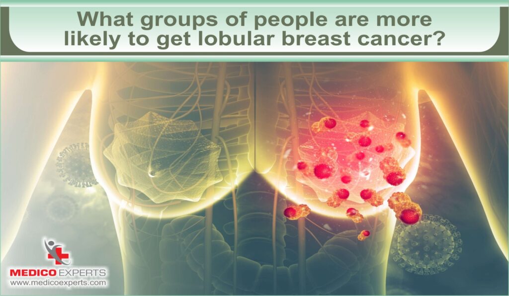 groups of people likely to get lobular breast cancer