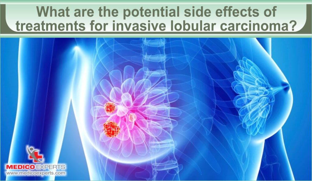 What are the potential side effects of treatments for invasive lobular carcinoma?