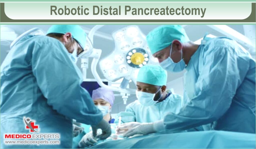 Robotic Distal Pancreatectomy