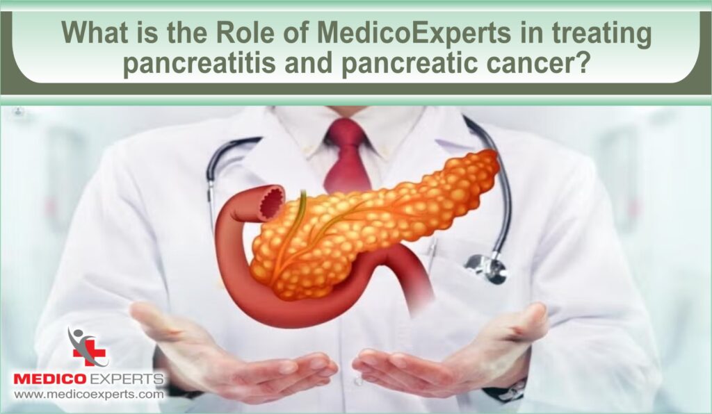 Role of MedicoExperts in treating pancreatitis and pancreatic cancer