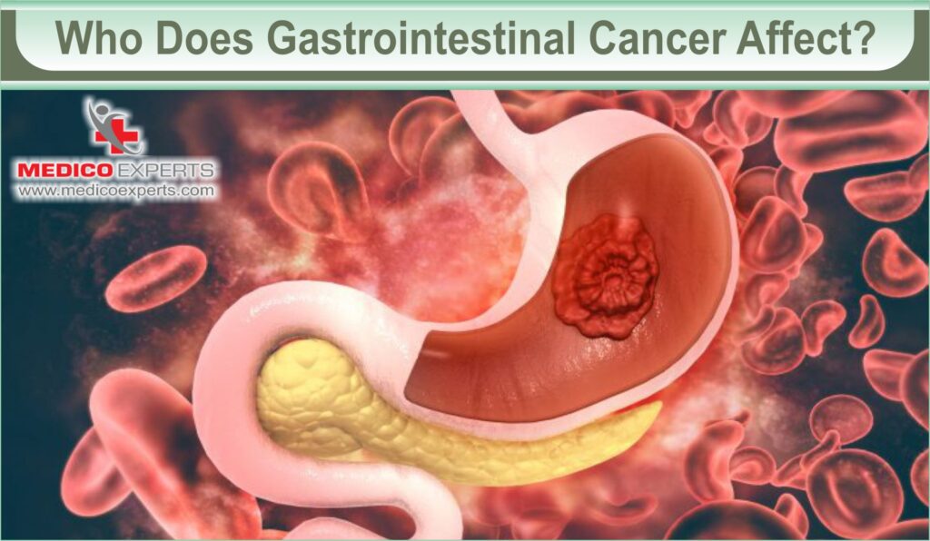 Who Does Gastrointestinal Cancer Affect
