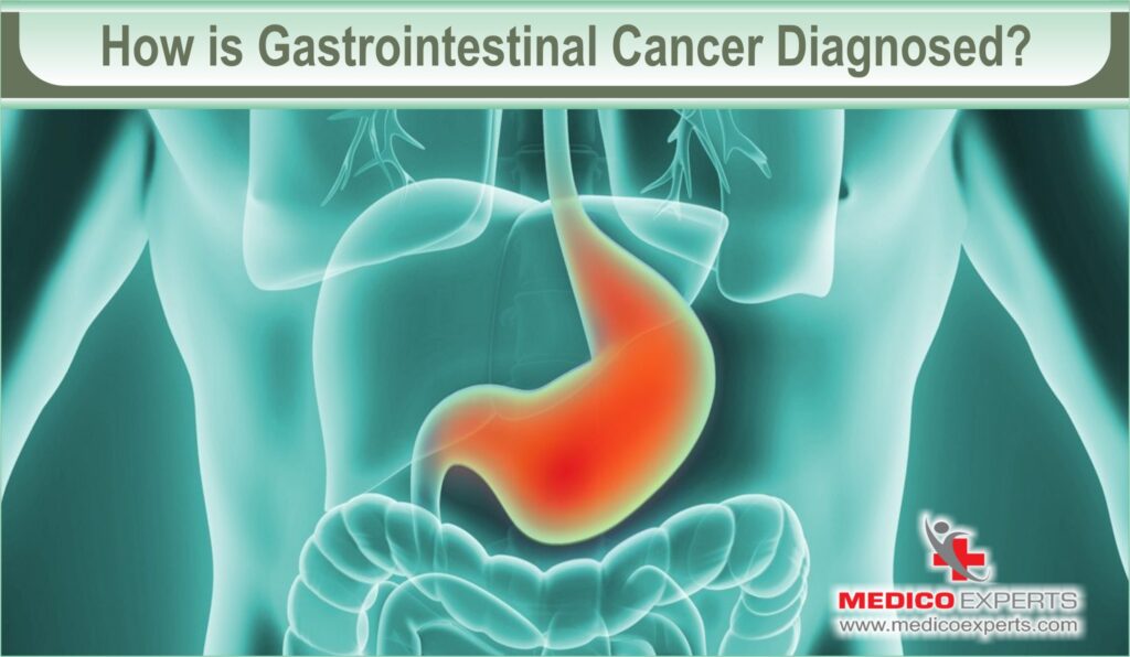 How is Gastrointestinal Cancer Diagnosed