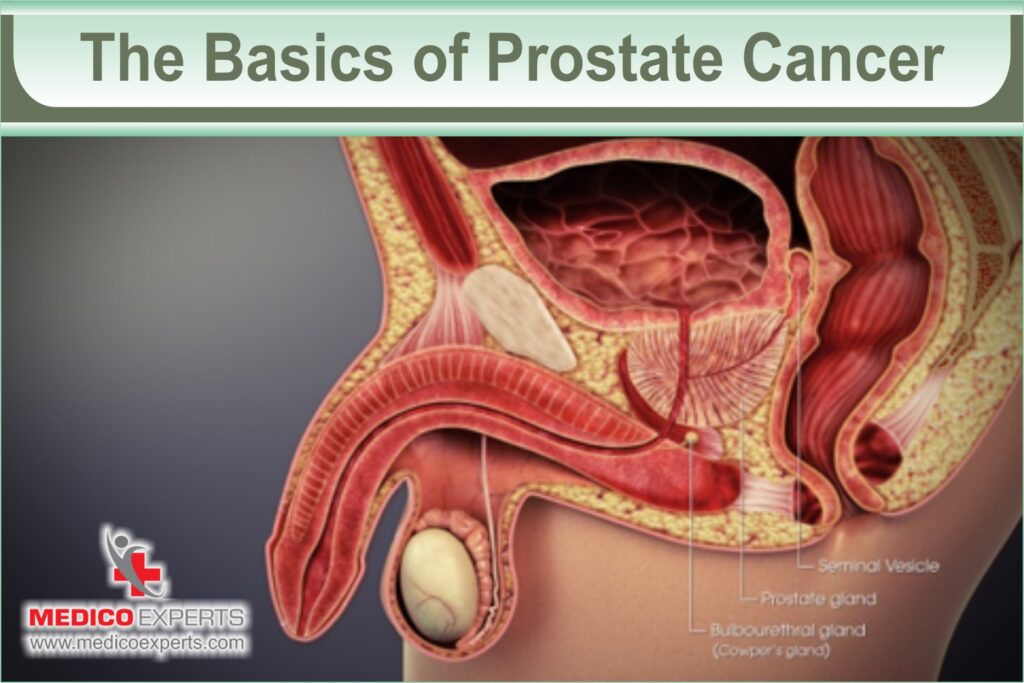 The Basics of Prostate Cancer