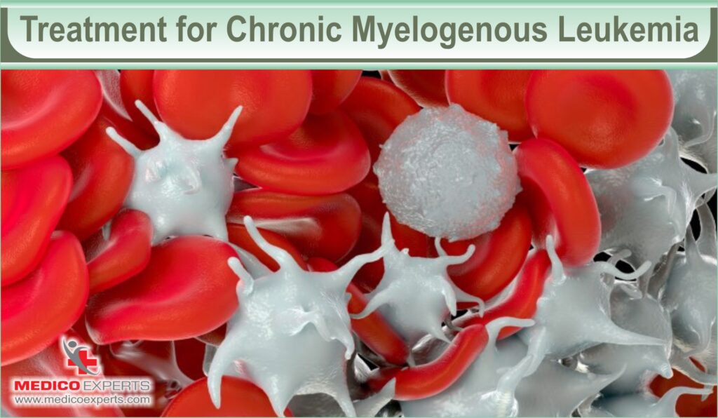 treatment for chronic myelogenous leukemia