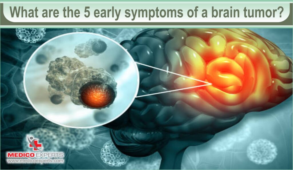 What are the 5 early symptoms of a brain tumor