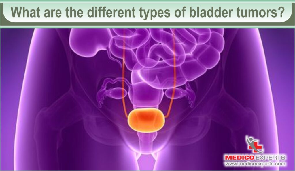 What are the different types of bladder tumors