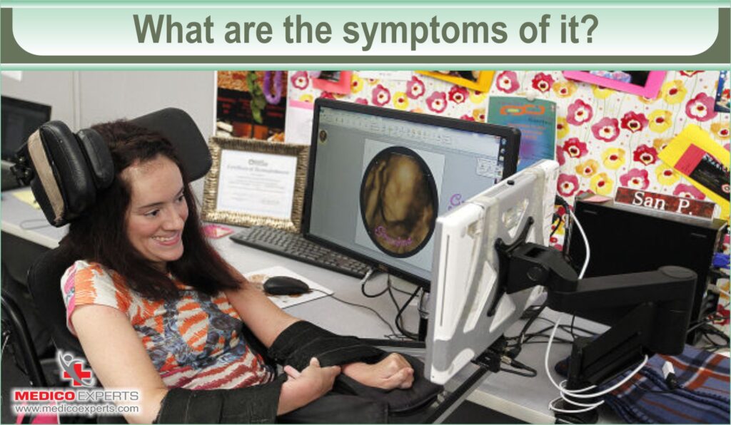 What are the symptoms of cerebral palsy
