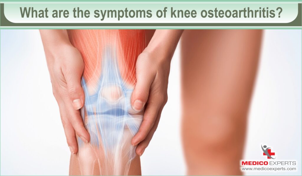 What are the symptoms of knee osteoarthritis