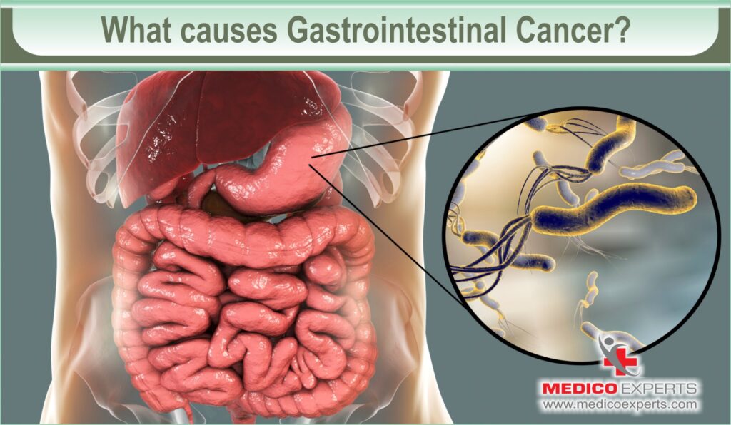 What causes Gastrointestinal Cancer