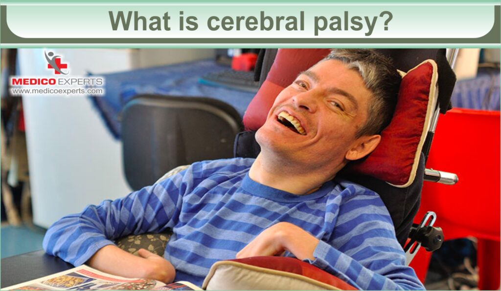 What is cerebral palsy