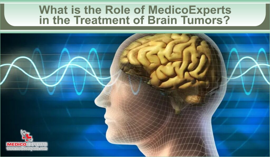 What is the Role of MedicoExperts in the Treatment of Brain Tumors