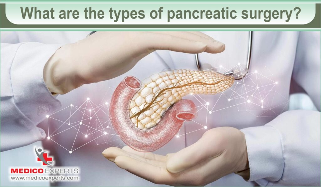 types of pancreatic surgery