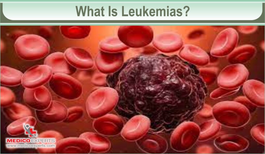 acute leukemia in adults