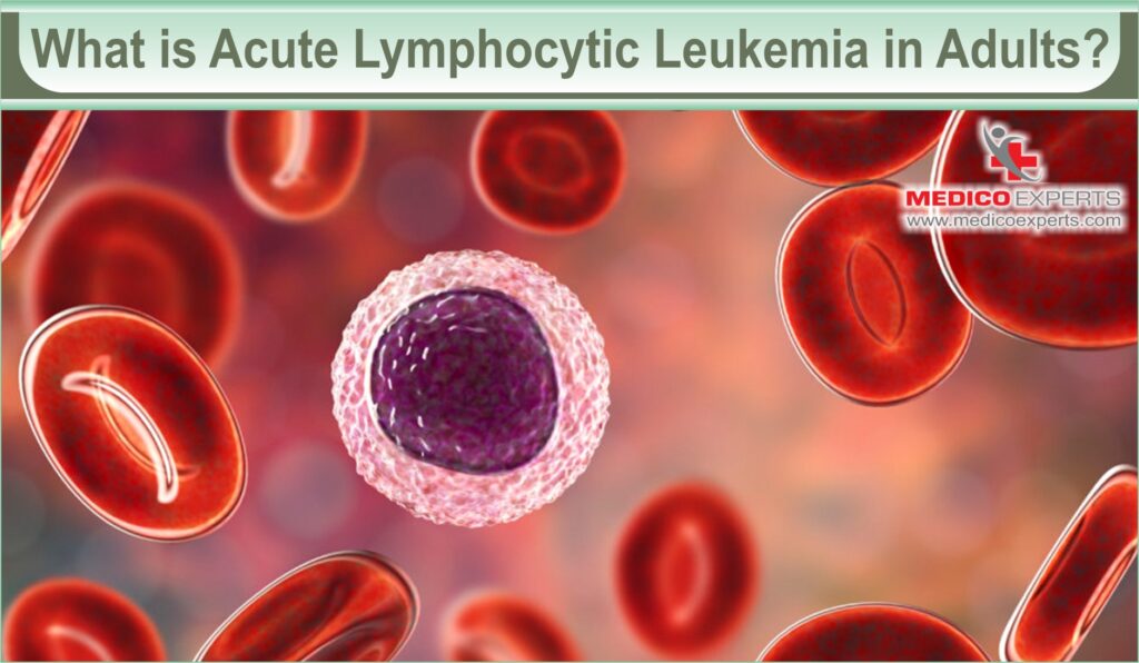 acute leukemia