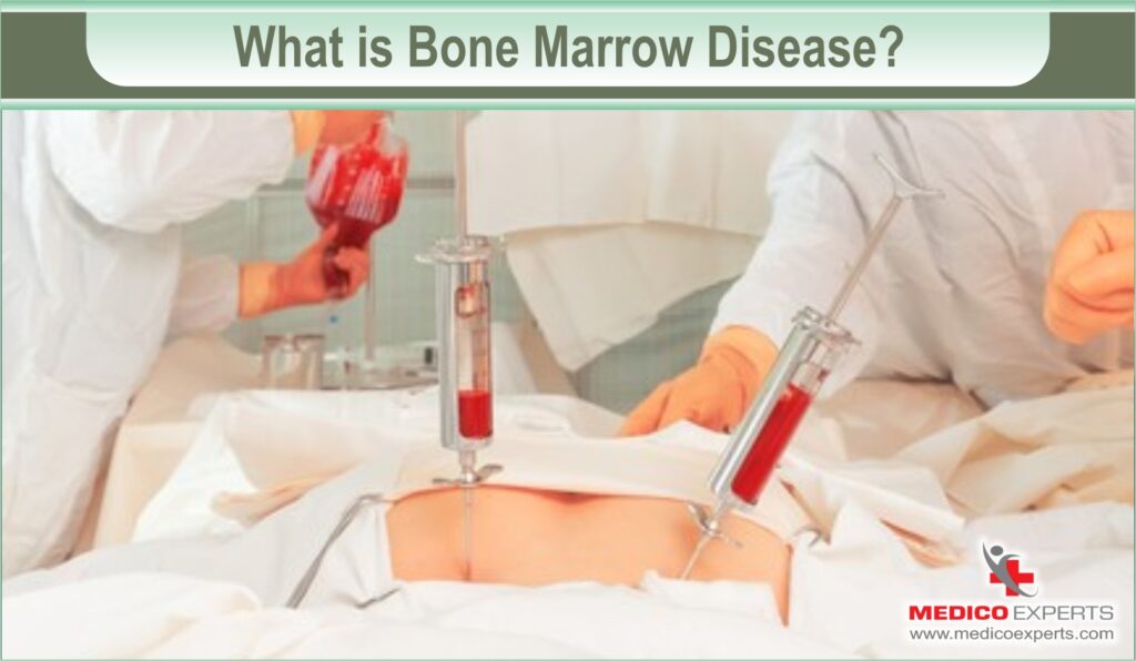 bone marrow disease
