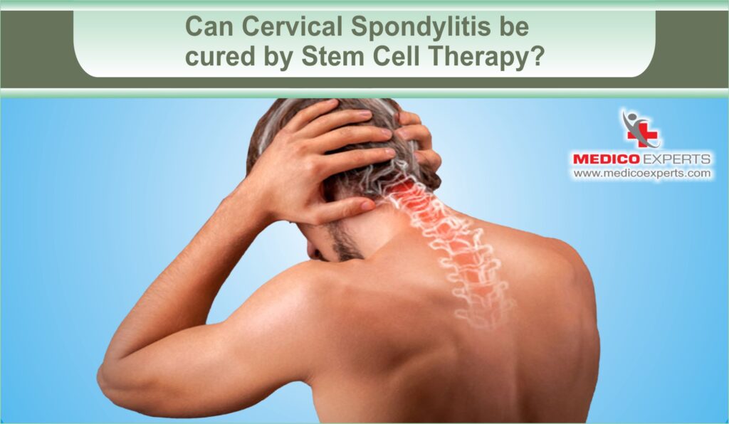 Can Cervical Spondylitis be cured by Stem Cell Therapy