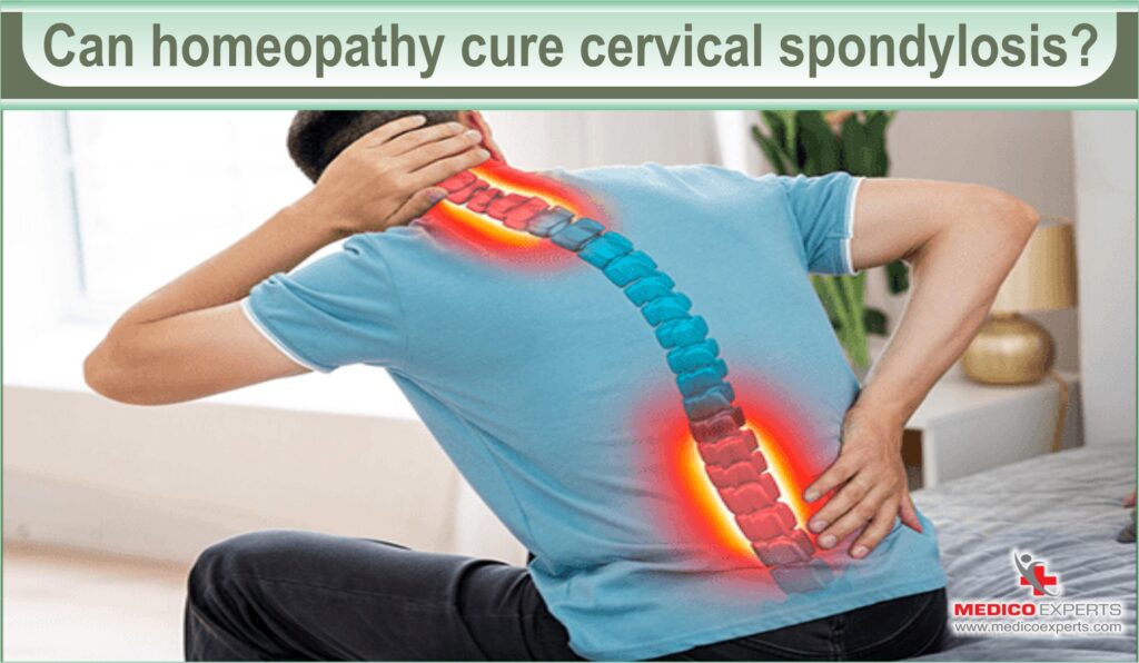 Can homeopathy cure cervical spondylosis
