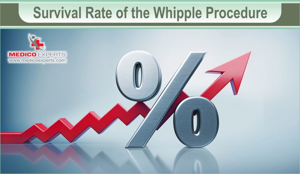 Survival Rate of the Whipple Procedure