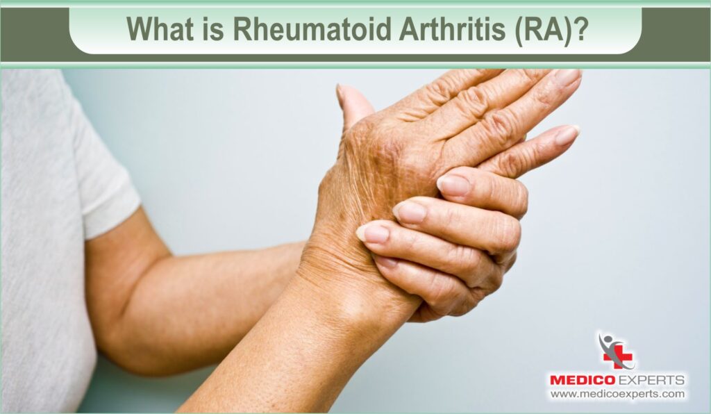 What is rheumatoid arthritis