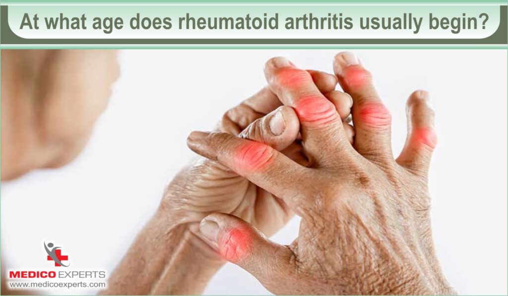 At what age does rheumatoid arthritis usually begin
