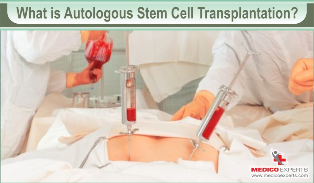 autologous bone marrow transplant