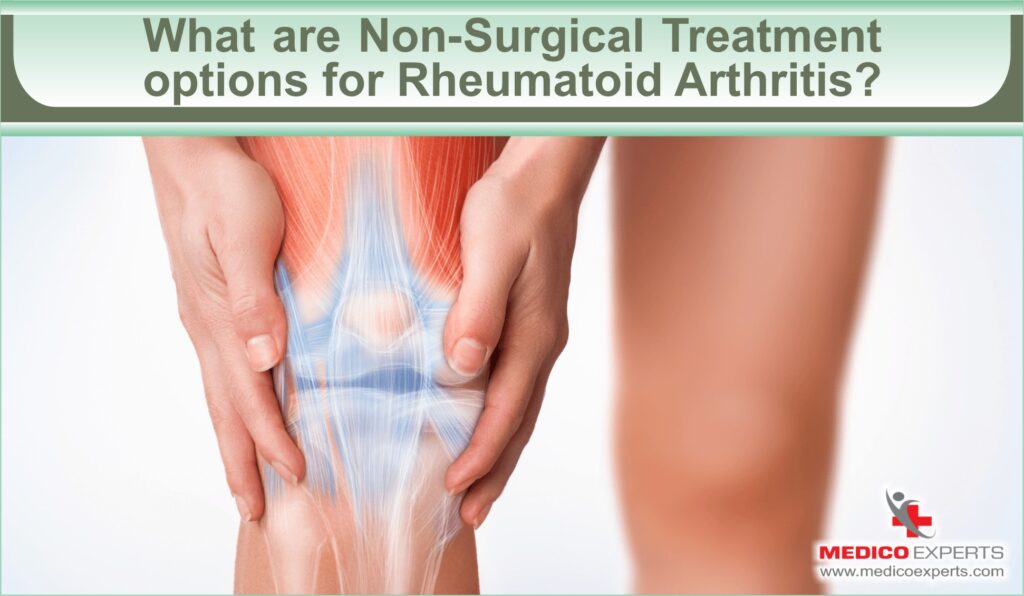 what are the non surgical treatment options for rheumatoid arthritis