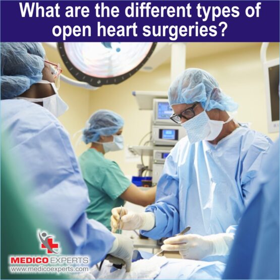 Different types of Open Heart Surgery in Nigeria Different types of Open Heart Surgery in Nigeria