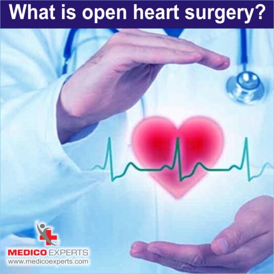 Open Heart Surgery in Nigeria Open Heart Surgery in Nigeria