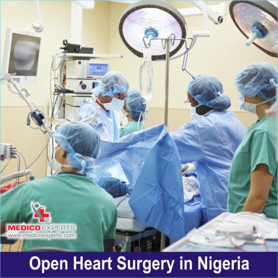 Open Heart Surgery perform in Nigeria by Indian surgeons Open Heart Surgery perform in Nigeria by Indian surgeons