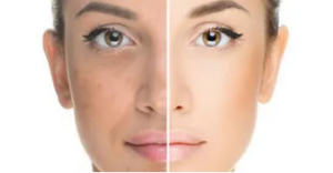 Tan removal glow ubtan face mask