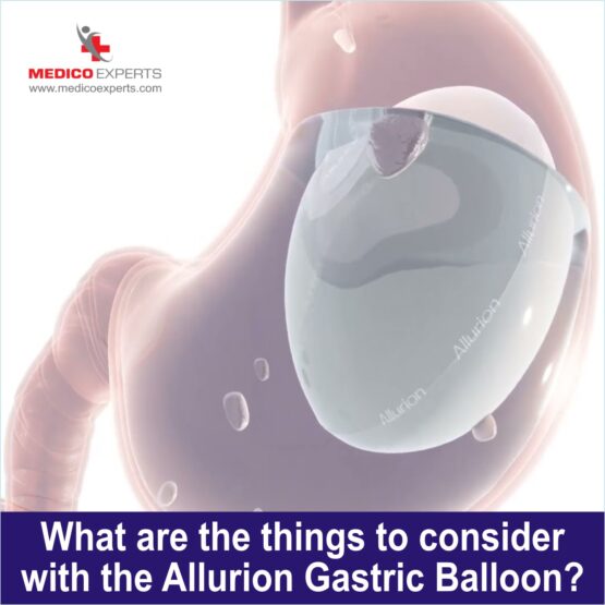 What are the things to consider with the Allurion Gastric Balloon