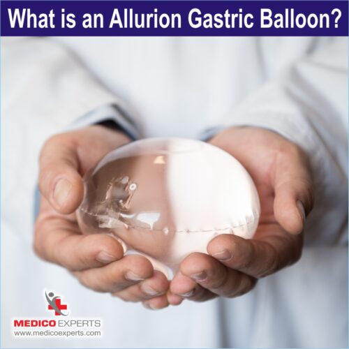 What is Allurion Gastric Balloon