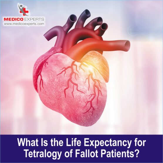 26ff2fff-63ad-44a9-a19e-03b36e9c26cc What is the Life Expectancy for Tetralogy of Fallot Patients?