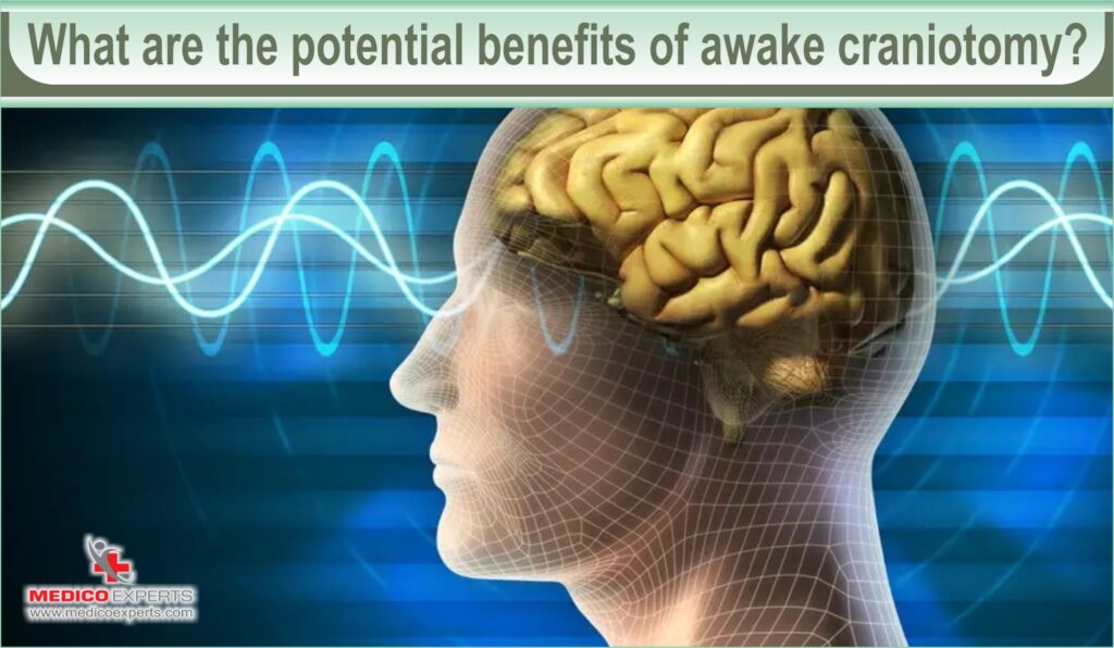 What are the potential benefits of awake craniotomy?