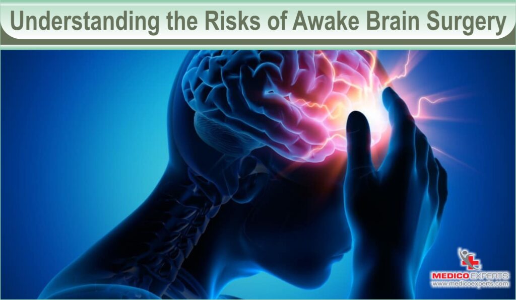 Understanding the Risks of Awake Brain Surgery