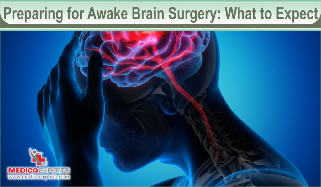 Preparing for Awake Brain Surgery: What to Expect