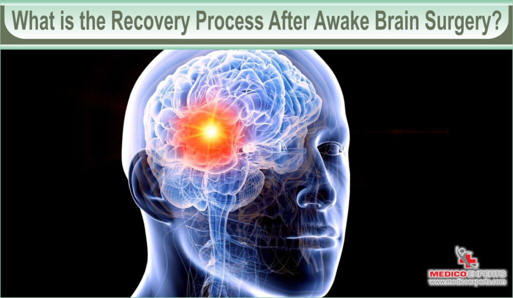 What is the Recovery Process After Awake Brain Surgery?