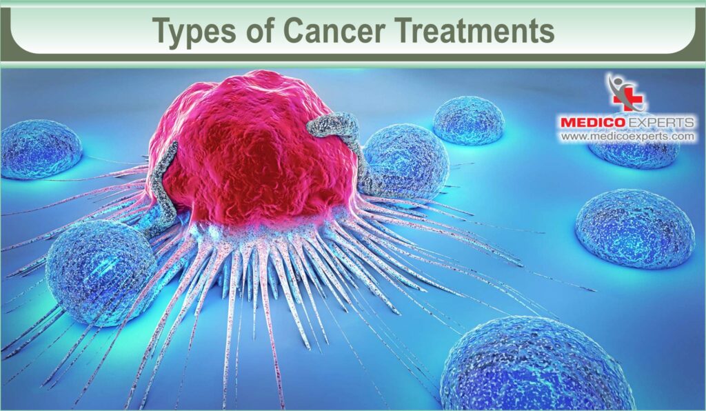 Types of Cancer Treatments